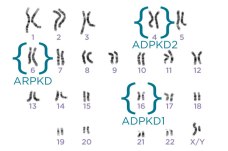 PKD chromosomes from PKD Foundation